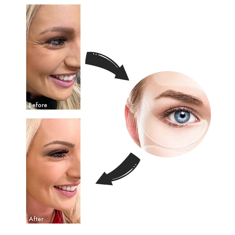 Nuevo botox Libre de Arrugas y Líneas de Expresión 18 Piezas